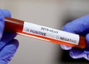 Satu Warga Inhil Kembali Terkonfirmasi Positif Covid-19