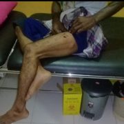 Warga Sialang Panjang Diserang Buaya dari Bawah Kolong Rumah