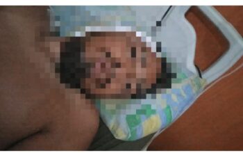 Ketua IWO Bantaeng Jadi Korban Pembacokan, Zulkifl Thahir: Pelaku Harus Segera Ditangkap
