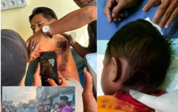 Serangan Monyet Liar Semakin Bertambah, Korban Gigitan Telah Mencapai Sebanyak 15 Orang