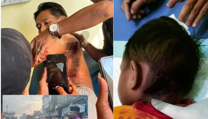 Serangan Monyet Liar Semakin Bertambah, Korban Gigitan Telah Mencapai Sebanyak 15 Orang